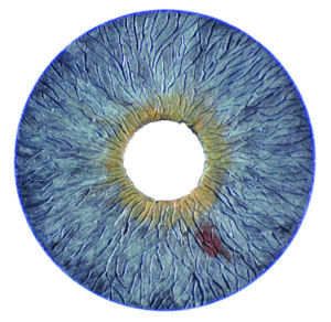 Picture of the Artificial Iris up close.